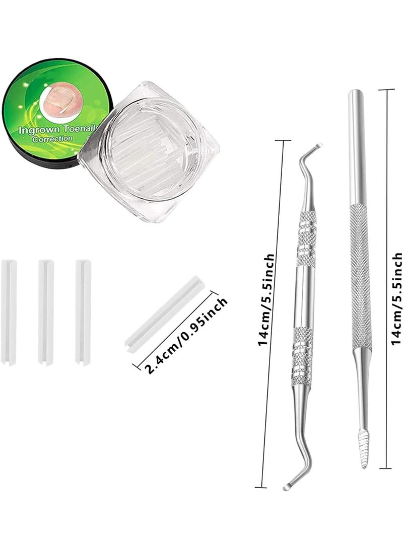 مجموعة تقويم الأسنان لأظافر القدم الداخلية ، بما في ذلك 30 بقعة تصحيح أظافر القدم الداخلية ، ومعدات حماية تصحيح أظافر القدم ، وأدوات إصلاح القدم ، ورفعات وملفات أظافر القدم الداخلية - Image 2